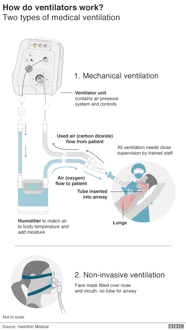 Detail Pictures Of Mechanical Ventilators Nomer 36