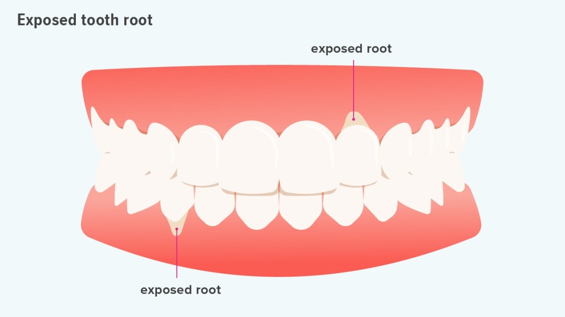 Detail Pictures Of Tooth Nomer 24