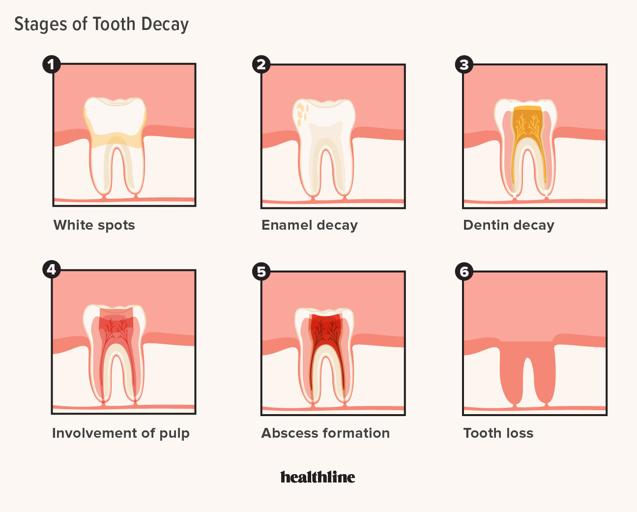 Detail Pictures Of Tooth Nomer 25