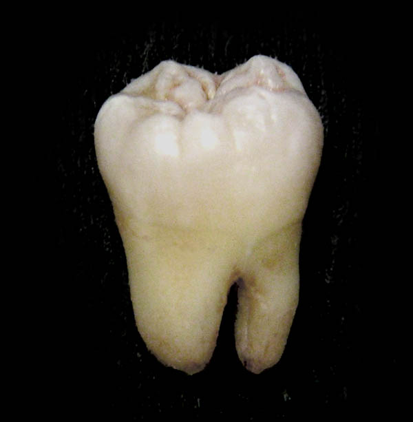 Detail Pictures Of Tooth Nomer 7