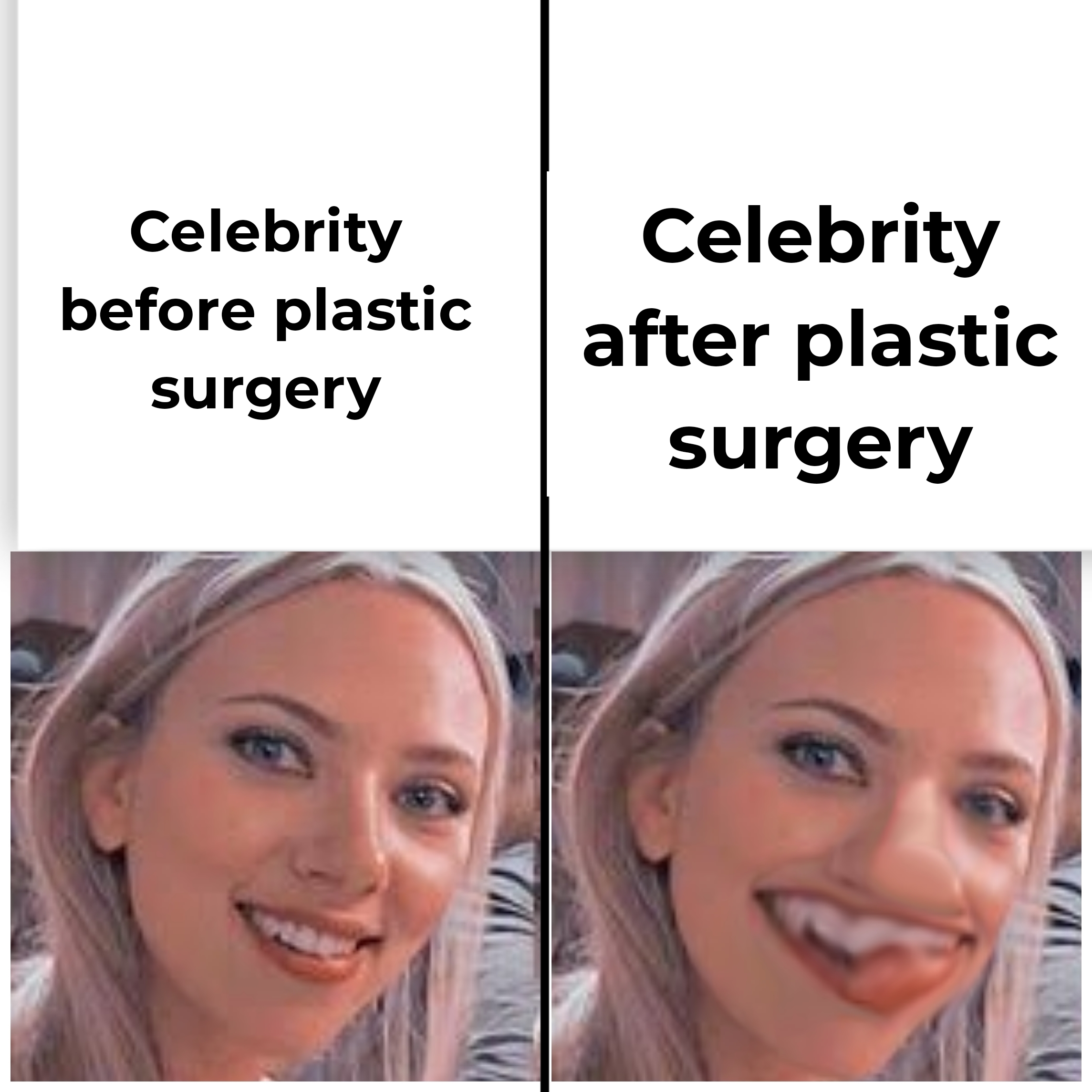 Detail Plastic Surgery Meme Nomer 11