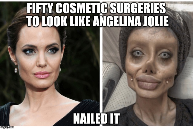 Detail Plastic Surgery Meme Nomer 19