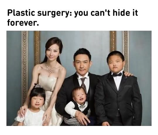 Detail Plastic Surgery Meme Nomer 8
