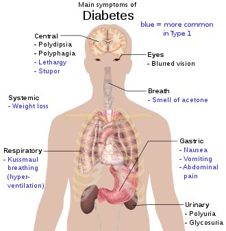 Detail Diabetes Melitus Dan Insipidus Nomer 21