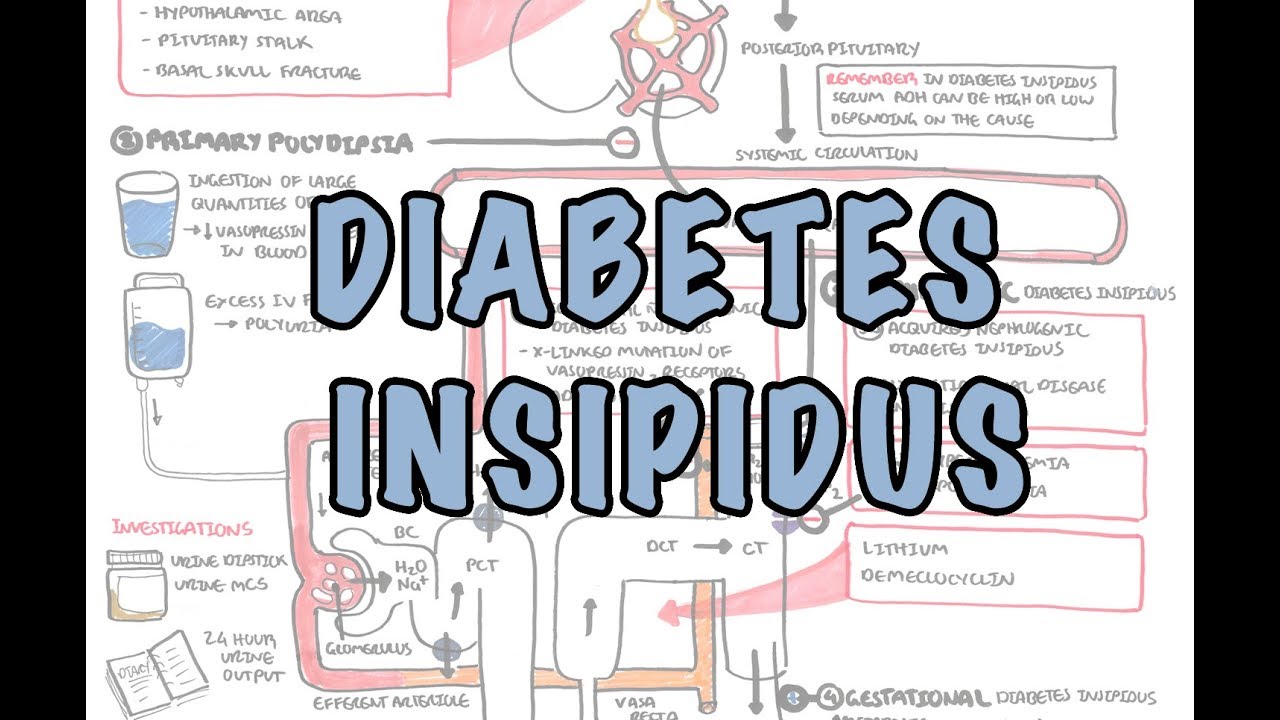 Detail Diabetes Melitus Dan Insipidus Nomer 48