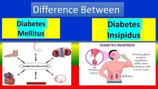 Detail Diabetes Melitus Dan Insipidus Nomer 7