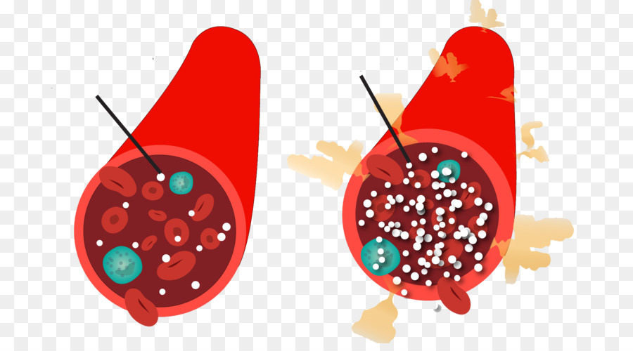 Detail Diabetes Mellitus Png Nomer 30