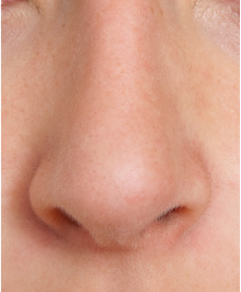 Detail Png Nose Nomer 17