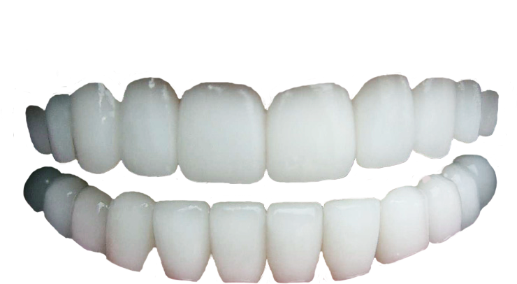Detail Png Teeth Nomer 3