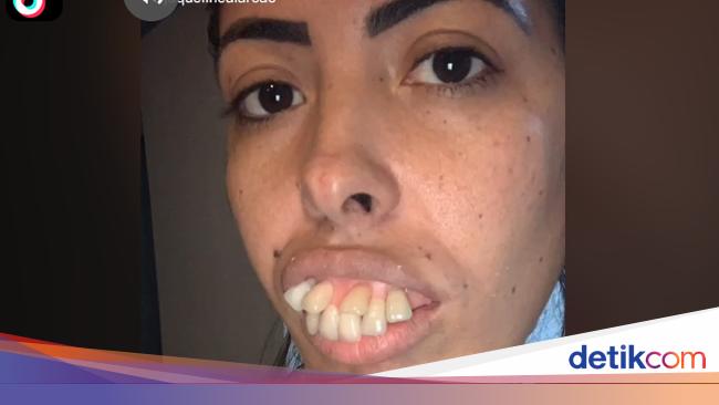 Detail Poto Wanita Jelek Nomer 34