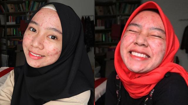 Detail Poto Wanita Jelek Nomer 39