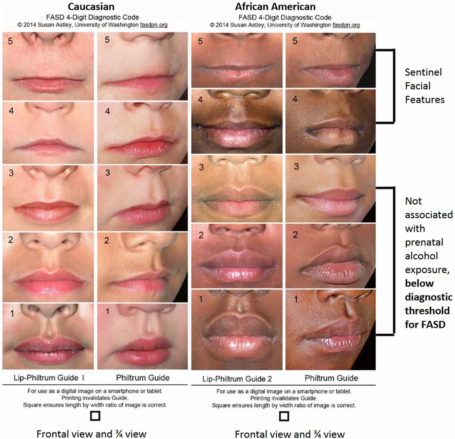 Detail Procheilon Lip Nomer 20