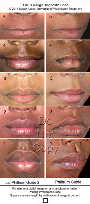 Detail Procheilon Lip Nomer 6