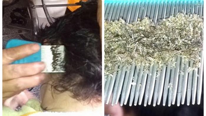 Detail Rambut Penuh Kutu Nomer 32