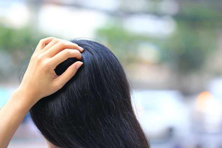 Detail Rambut Penuh Kutu Nomer 47