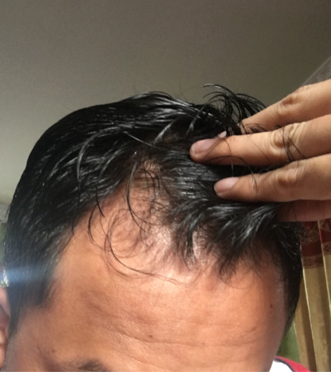 Detail Rambut Rontok Kaskus Nomer 19