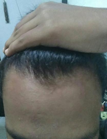 Detail Rambut Rontok Kaskus Nomer 20