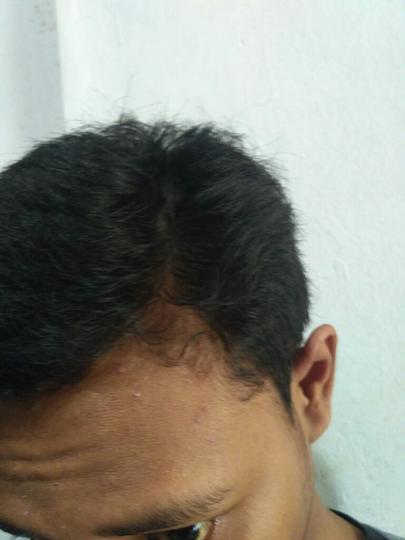Detail Rambut Rontok Kaskus Nomer 23