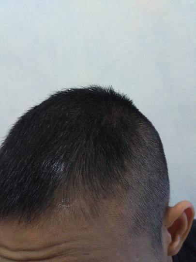 Detail Rambut Rontok Kaskus Nomer 24