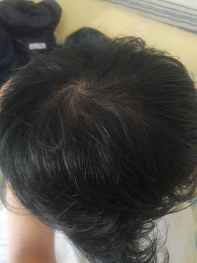 Detail Rambut Rontok Kaskus Nomer 27