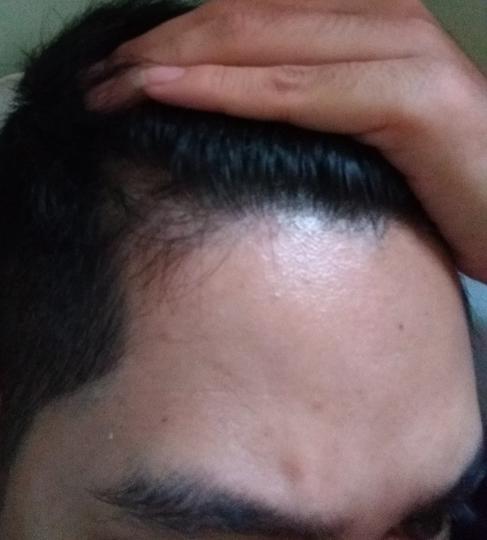 Detail Rambut Rontok Kaskus Nomer 29