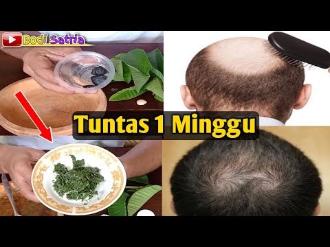 Detail Rambut Rontok Kaskus Nomer 33