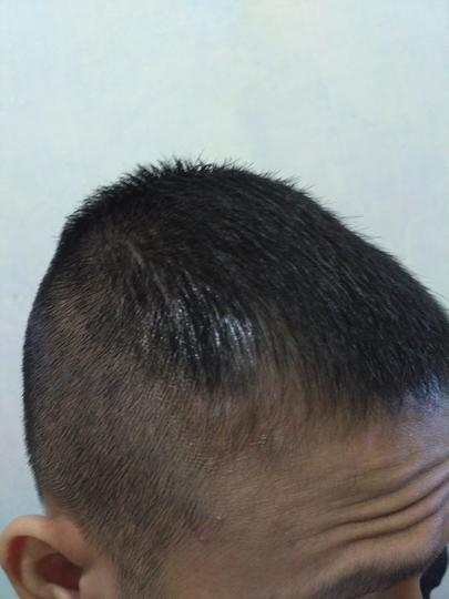 Detail Rambut Rontok Kaskus Nomer 34