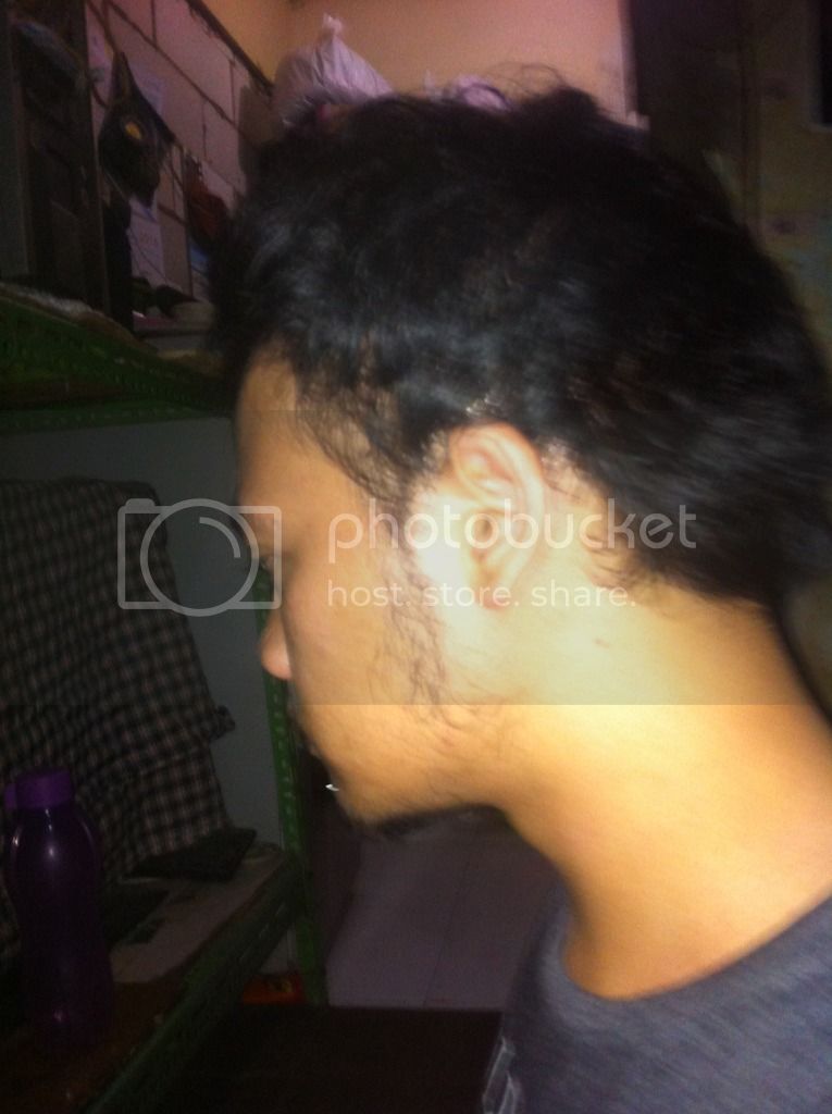 Detail Rambut Rontok Kaskus Nomer 35