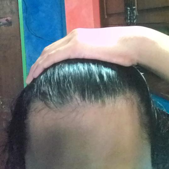 Detail Rambut Rontok Kaskus Nomer 36