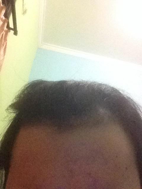 Detail Rambut Rontok Kaskus Nomer 38
