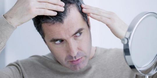 Detail Rambut Rontok Kaskus Nomer 40
