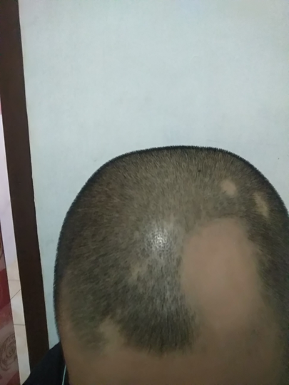 Detail Rambut Rontok Kaskus Nomer 42