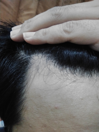 Detail Rambut Rontok Kaskus Nomer 45