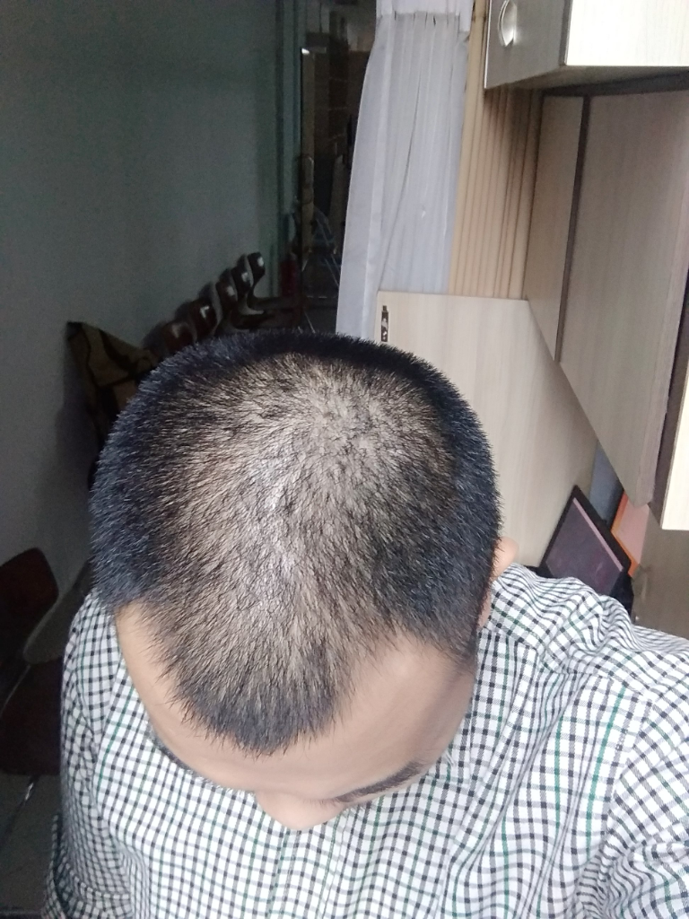 Detail Rambut Rontok Kaskus Nomer 49