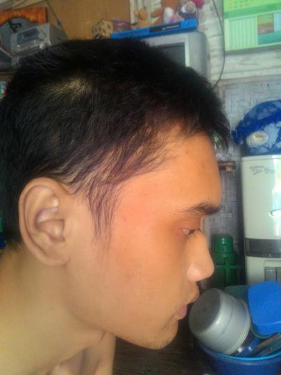 Detail Rambut Rontok Kaskus Nomer 50