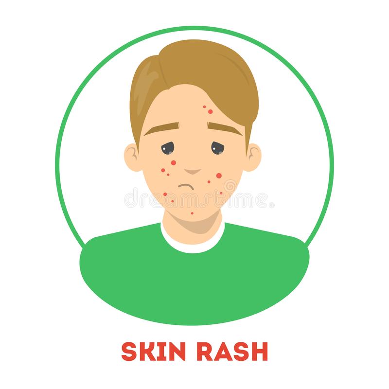 Detail Rash Clipart Nomer 9