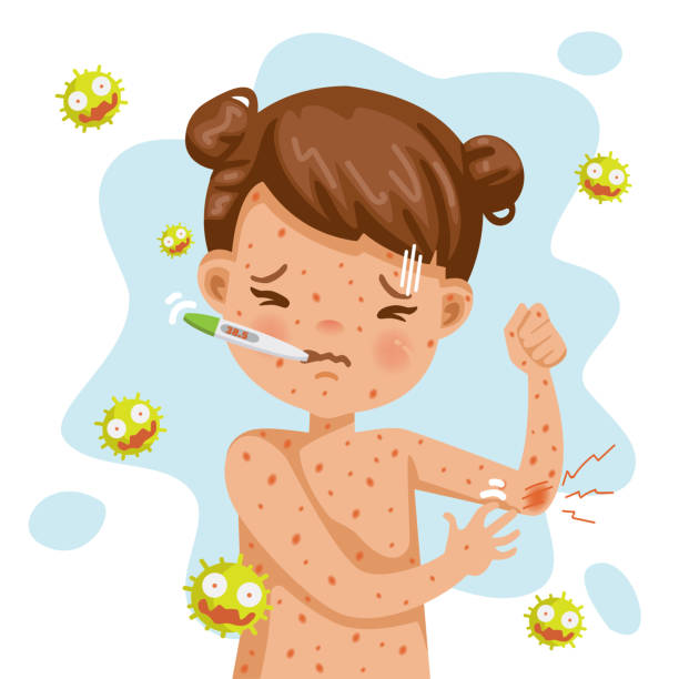 Detail Rash Clipart Nomer 32