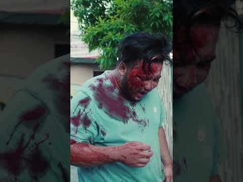 Detail Real Accident Blood Images Nomer 51