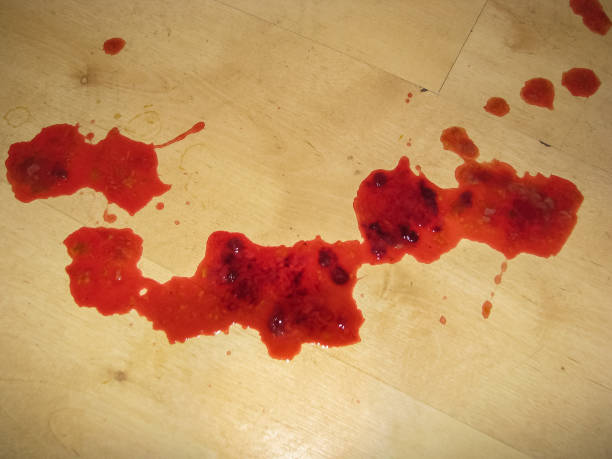 Detail Real Blood Pictures Nomer 6