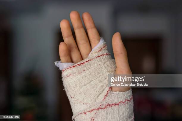 Detail Real Hand Bandage Pic Nomer 15