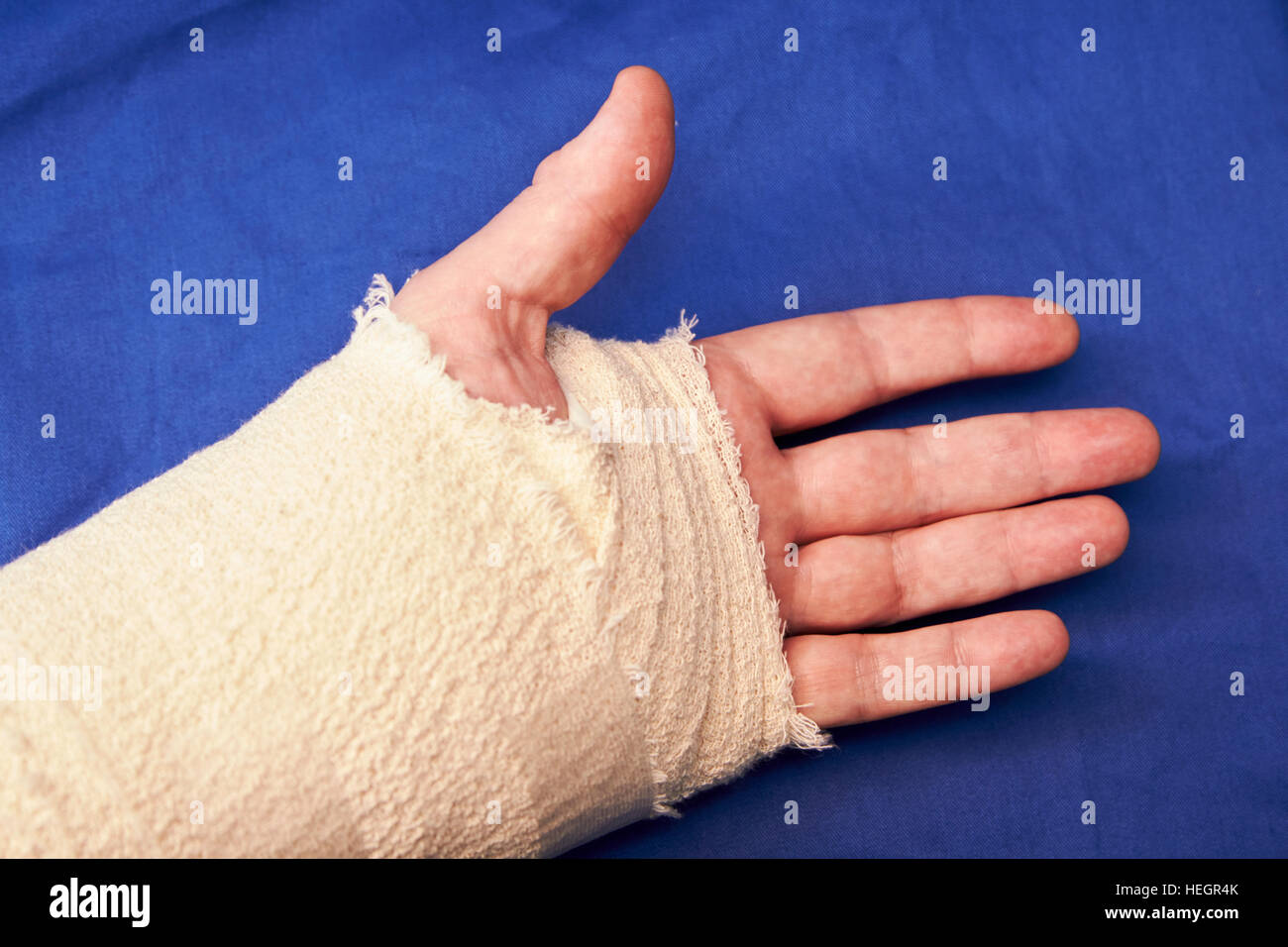 Detail Real Hand Bandage Pic Nomer 39