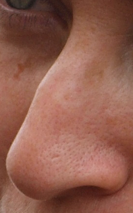 Detail Real Nose Nomer 2