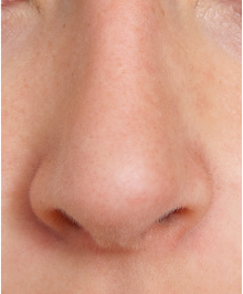 Detail Real Nose Nomer 7