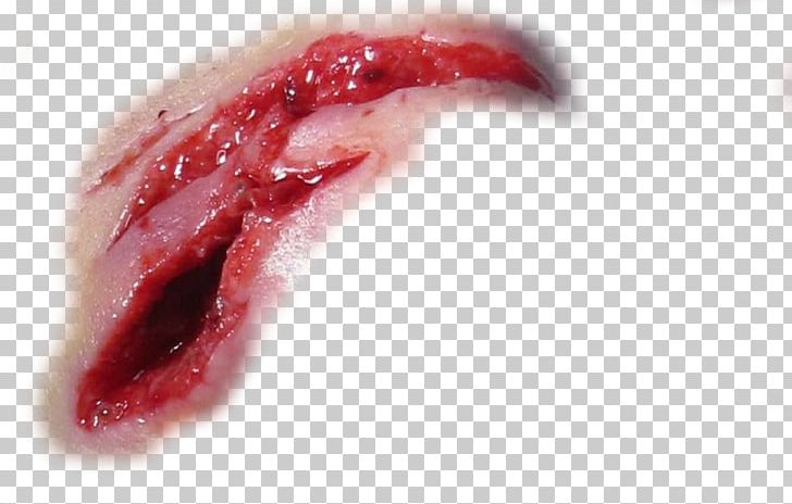 Detail Realistic Scar Png Nomer 16