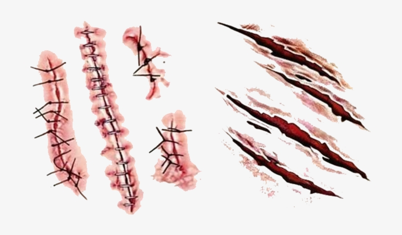 Detail Realistic Scar Png Nomer 6