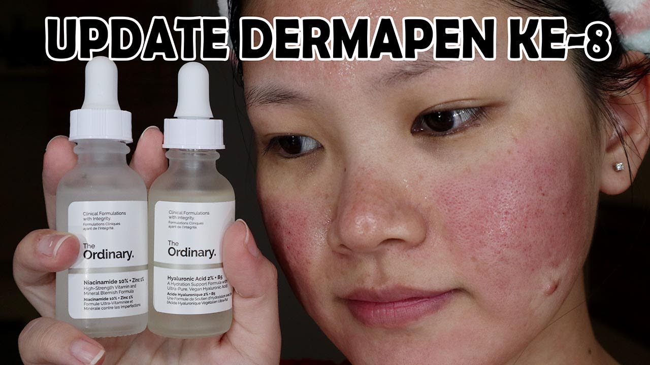 Detail Review Dermapen Di Rumah Nomer 6