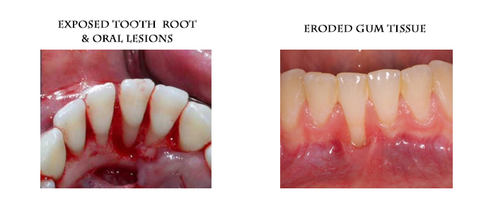 Detail Does Snake Eyes Piercing Mess Up Your Teeth Nomer 51