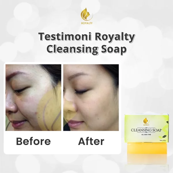 Detail Sabun Cleansing Soap Nomer 21