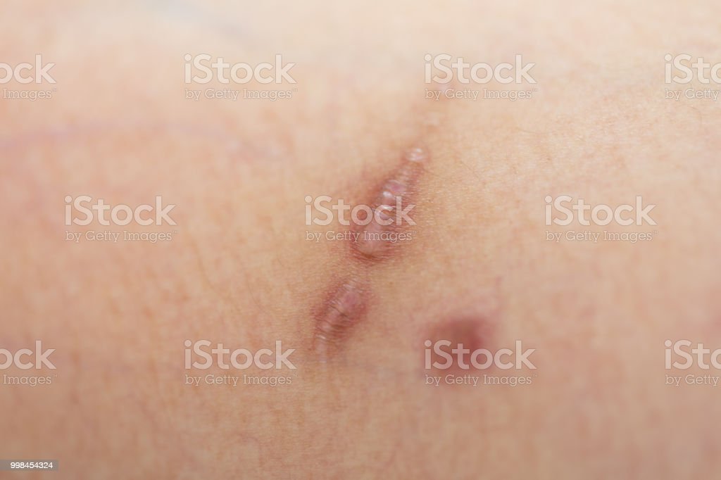 Detail Scar Download Nomer 17