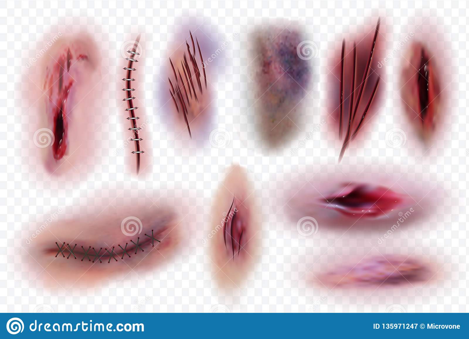 Detail Scar Wound Clipart Nomer 20